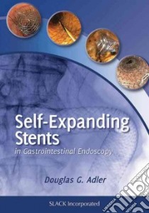Self-Expanding Stents in Gastrointestinal Endoscopy libro in lingua di Adler Douglas G. M.D. (EDT)
