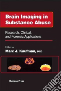 Brain Imaging in Substance Abuse libro in lingua di Kaufman Marc J. Ph.D. (EDT), Frascella Joseph Ph.D. (FRW)