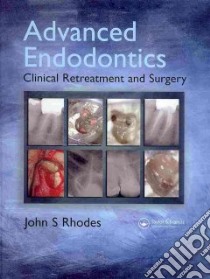 Advanced Endodontics libro in lingua di Rhodes John S.