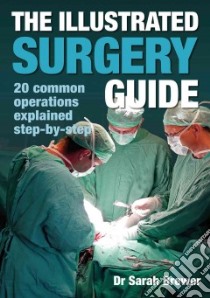 Illustrated Surgery Guide libro in lingua di Sarah Brewer