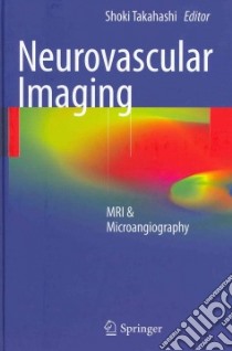 Neurovascular Imaging libro in lingua di Takahashi Shoki (EDT)