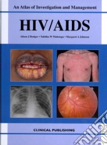 Hiv/aids libro in lingua di Rodger Alison J. (EDT), Mahungu Tabitha W. (EDT), Johnson Margaret A. (EDT)