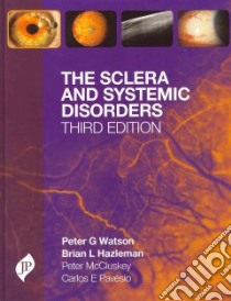 The Sclera and Systemic Disorders libro in lingua di Watson Peter G., Hazleman Brian L., McCluskey Peter M. M.D., Pavesio Carlos E. M.D.