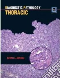 Diagnostic Pathology: Thoracic libro in lingua di Saul Suster