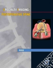 Specialty Imaging: Postoperative Spine libro in lingua di Jeffrey Ross