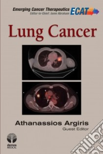 Lung Cancer libro in lingua di Argiris Athanassios M.D. (EDT), Alexander A. B. (EDT)