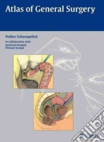 Atlas of General Surgery libro in lingua di Schumpelick Volker