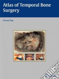 Atlas of Temporal Bone Surgery libro in lingua di Ulug Tuncay M.D.