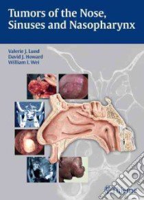 Tumors of the Nose, Sinuses and Nasopharynx libro in lingua di Lund Valerie J., Howard David J., Wei William I.