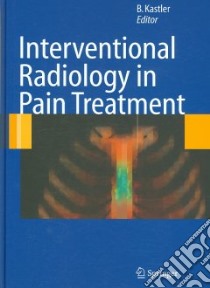 Interventional Radiology in Pain Treatment libro in lingua di Kastler Bruno (EDT), Barral Fabrice-Guy (EDT), Fergane Bernard (EDT), Pereira Philippe (EDT)