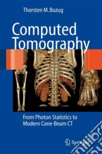 Computed Tomography libro in lingua di Buzug Thorsten M.