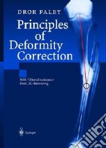 Principles of Deformity Correction libro in lingua di Paley Dror