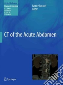 Ct of the Acute Abdomen libro in lingua di Taourel Patrice (EDT), Baert Albert L. (FRW)