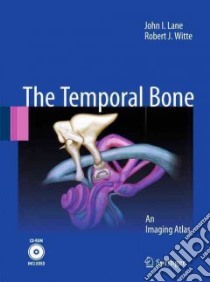 Temporal Bone libro in lingua di Lane John I., Witte Robert J.