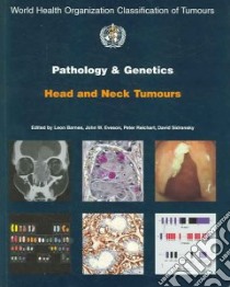 Pathology And Genetics of Head and Neck Tumours libro in lingua di Barnes Leon (EDT), Eveson John W. (EDT), Reichart Peter A. (EDT), Sidransky David (EDT)