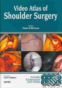 Video Atlas of Shoulder Surgery libro in lingua di McCann Peter D. M.D. (EDT)
