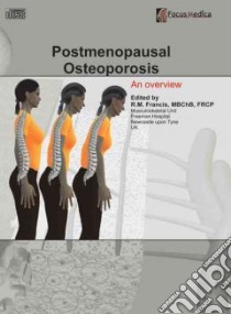 Postmenopausal Osteoporosis libro in lingua di Francis R. M. (EDT)