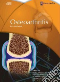 Osteoarthritis libro in lingua di Dieppe Paul (EDT)