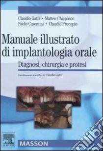 Manuale illustrato di implantologia orale. Diagnosi, chirurgia e protesi. Ediz. illustrata libro