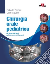 Chirurgia orale pediatrica. Un nuovo approccio agli interventi più frequenti libro di Barone Roberto; Clauser Carlo