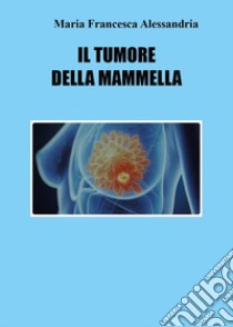 Il tumore della mammella libro di Alessandria Maria Francesca