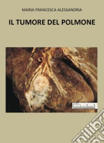 Il tumore nel polmone libro di Alessandria Maria Francesca