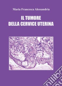 Il tumore della cervice uterina libro di Alessandria Maria Francesca